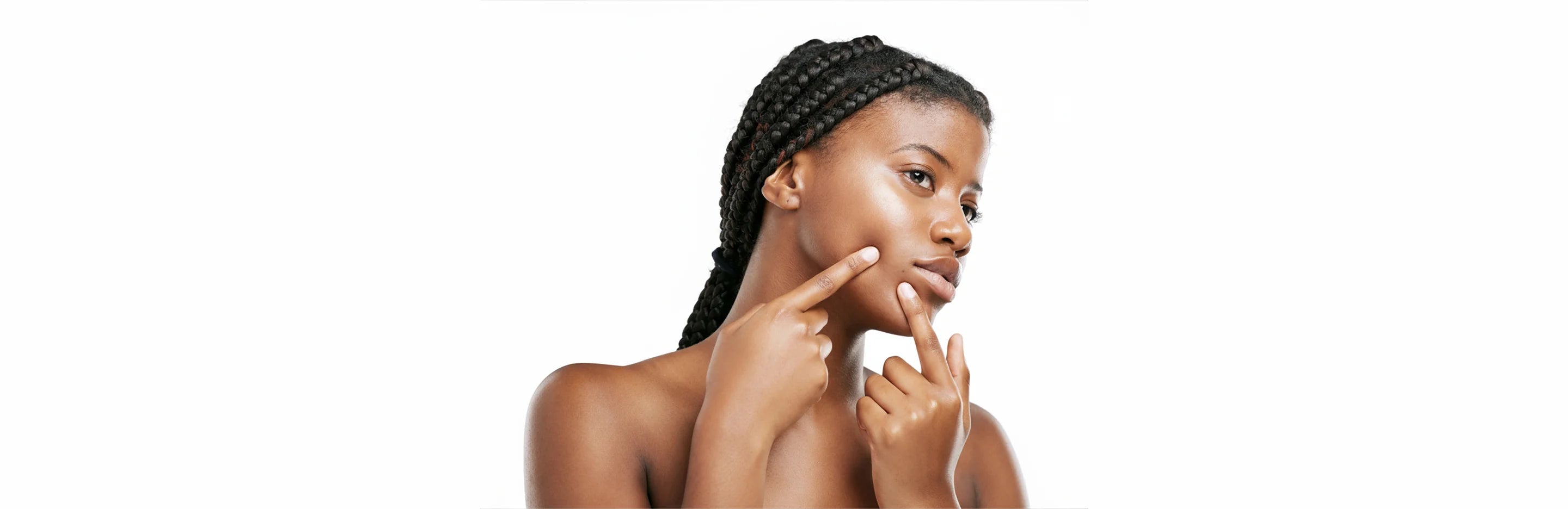 Model highlighting areas where makeup usually cakes or breaks out